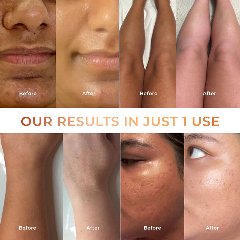 Niconi Tan Vanish Gluta-Kojic Skin Polish